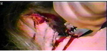 Another shot of the eyeball slice from THE NEW YORK RIPPER